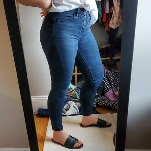 [American Eagle] Hi-Rise Button-Front Jeggings